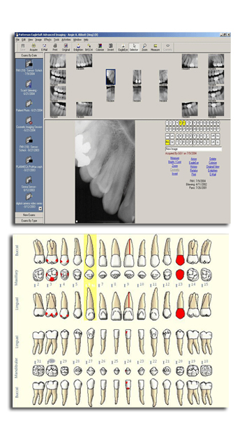 Eaglesoft Dental Charting